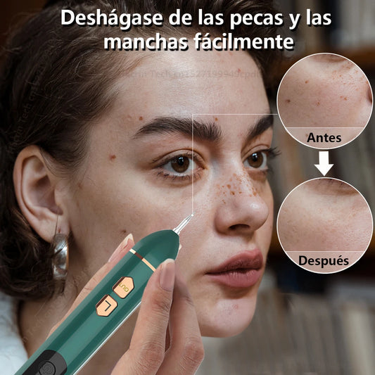 Pluma de Plasma láser eliminador de etiquetas de piel, eliminador de lunares y verrugas, eliminación de puntos negros Nevus, lápiz eliminador de lunares del cuerpo de la cara